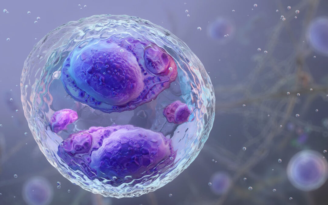 1st deaths in cyclosporiasis outbreak reported in Michigan as cases surpass 11,000